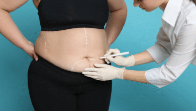 weight loss surgery