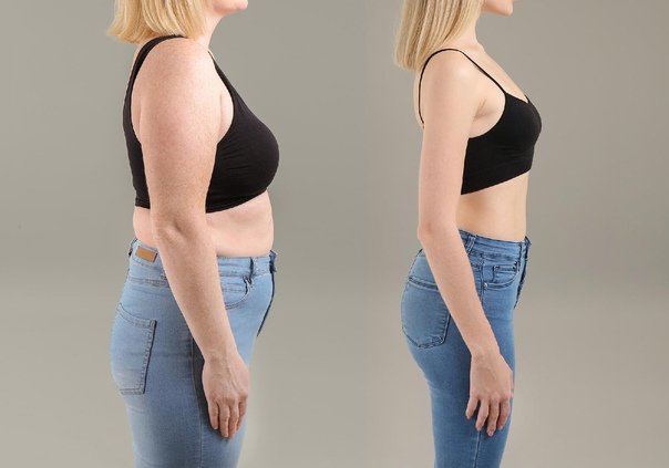 weight loss