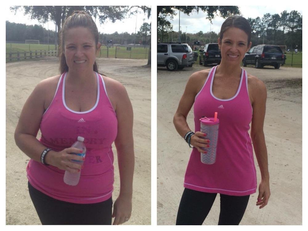 Benefits of Using Weight Loss Injections for Obesity